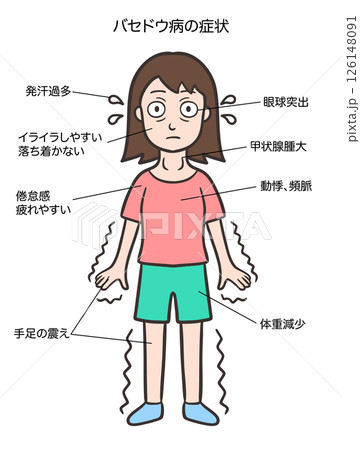 バセドウ病のサイン、特徴的な症状、女性 126148091