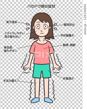 バセドウ病のサイン、特徴的な症状、女性 126148091