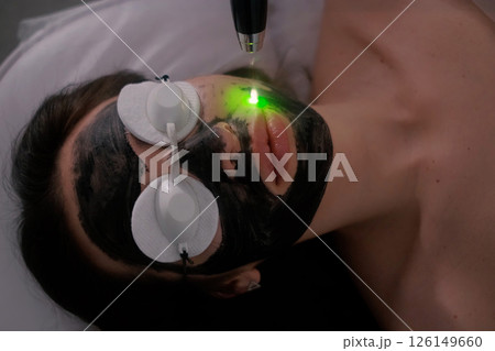 A woman is undergoing a carbon laser facial treatment. Her face is covered with a black carbon mask, protective goggles shield her eyes. A woman is undergoing a carbon laser facial treatment. Her face is covered with a black carbon mask, protective goggles shield her eyes. 126149660