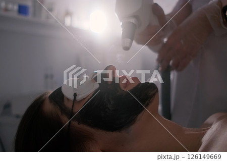 A woman is undergoing a carbon laser facial treatment. Her face is covered with a black carbon mask, protective goggles shield her eyes. A woman is undergoing a carbon laser facial treatment. Her face is covered with a black carbon mask, protective goggles shield her eyes. 126149669