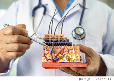 Asian dermatologist doctor holding skin structure model anatomy for treatment in hospital, hair transplant. Asian dermatologist doctor holding skin structure model anatomy for treatment in hospital, hair transplant. 126156243