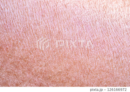 dry and dehydrated human skin texture background 126166972