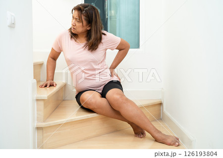 Asian lady fall down the stairs and pain at knee because slippery surfaces. Asian lady fall down the stairs and pain at knee because slippery surfaces. 126193804
