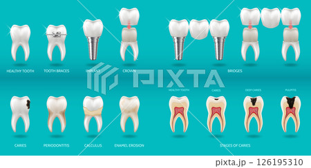 Dental Health and Treatment Options Infographic 126195310