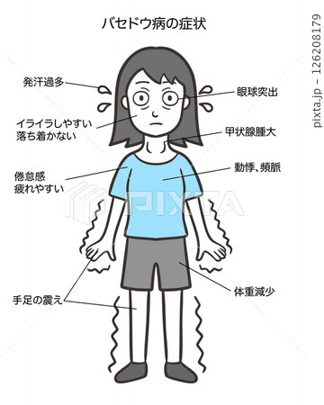 バセドウ病のサイン、特徴的な症状、女性 126208179