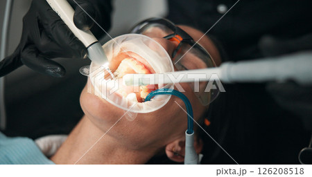 Equipment, medical and mouth of patient with dentist in office for appointment, checkup or operation. Dental, filling or hygiene with medicine professional and woman at clinic for healthcare Equipment, medical and mouth of patient with dentist in office for appointment, checkup or operation. Dental, filling or hygiene with medicine professional and woman at clinic for healthcare 126208518
