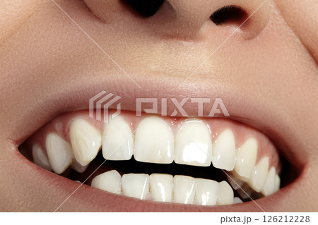 Dental Beauty. Beautiful Macro with perfect White Teeth. Fashion Naturel Lips Make-up. Whitening Tooth, Wellness Treatment 126212228