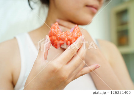 Hyperthyroidism, Overactive Thyroid, Thyroid Lymphoma, Asian woman with thyroid gland human anatomy model. Hyperthyroidism, Overactive Thyroid, Thyroid Lymphoma, Asian woman with thyroid gland human anatomy model. 126221400