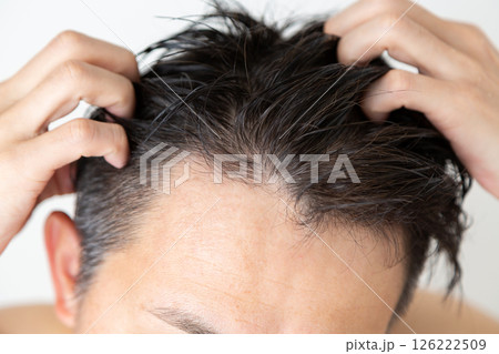 生え際の薄毛に悩むミドル男性 生え際の薄毛に悩むミドル男性 126222509