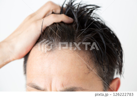 生え際の薄毛に悩むミドル男性 126222783