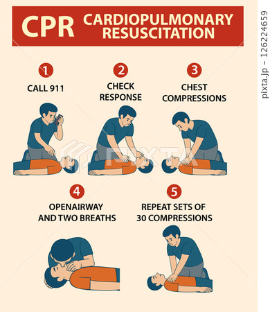 Step-by-Step CPR Instructional Vector Illustration 126224659