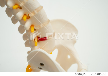 Human spinal nerve and bone with Intervertebral disc. Human spinal nerve and bone with Intervertebral disc. 126230592