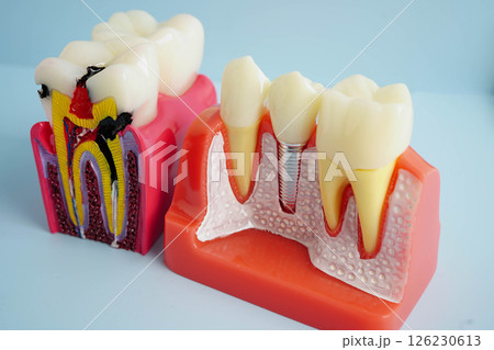 Dental teeth model on white background for learn about dentistry. 126230613