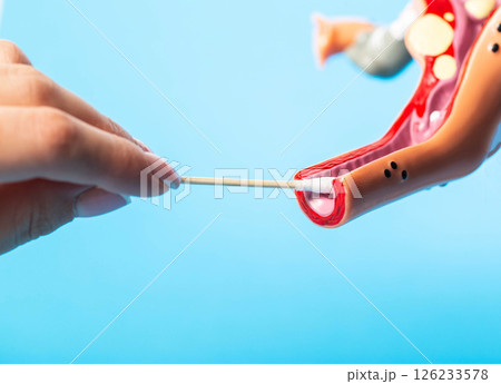 Girl takes a smear on flora from a female medical model on a blue background. Concept microscopy and smear on flora and infections. Copy space for text 126233578