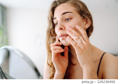 Beautiful woman with problematic skin looks in her small mirror. Cosmetology. Skin care concept. 126236408