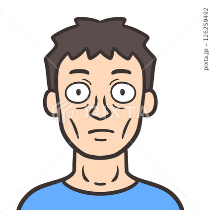 バセドウ病の症状が出ている男性の顔 バセドウ病の症状が出ている男性の顔 126259492