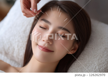 AI生成画像：鍼治療を受ける女性 126262970