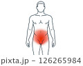 Infographics pelvic discomfort information about pelvic pain in men using red shading on silhouette , increasing health awareness, infographic design improves patient engagement in education 126265984