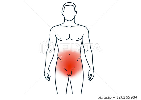 Infographics pelvic discomfort information about pelvic pain in men using red shading on silhouette , increasing health awareness, infographic design improves patient engagement in education 126265984