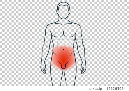 Infographics pelvic discomfort information about pelvic pain in men using red shading on silhouette , increasing health awareness, infographic design improves patient engagement in education 126265984