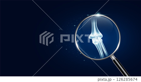 Elbow bone inside magnifying glass with scan search and blue glowing neon heart pulse. Medical health care. Body health check up examining organ. Vector. Elbow bone inside magnifying glass with scan search and blue glowing neon heart pulse. Medical health care. Body health check up examining organ. Vector. 126285674