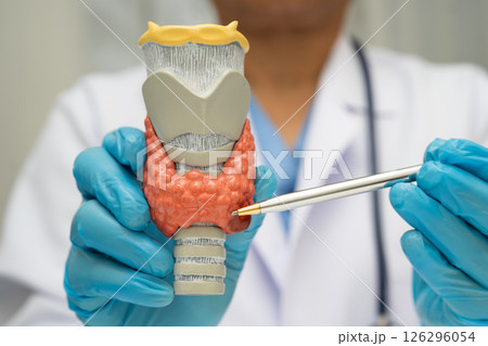 Hyperthyroidism, Overactive Thyroid, Thyroid Lymphoma, Asian doctor with thyroid gland human anatomy model in hospital. Hyperthyroidism, Overactive Thyroid, Thyroid Lymphoma, Asian doctor with thyroid gland human anatomy model in hospital. 126296054