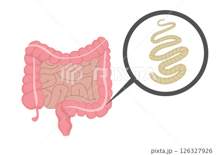 Tapeworm living in human intestine, causing parasitic infection 126327926