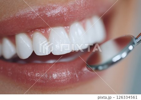 Detailed image of a woman's smile with perfect, white, and well-aligned teeth 126334561