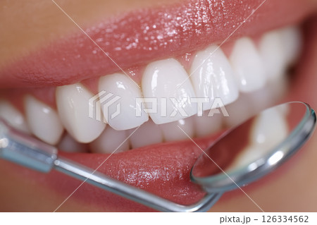 Detailed image of a woman's smile with perfect, white, and well-aligned teeth Detailed image of a woman's smile with perfect, white, and well-aligned teeth 126334562