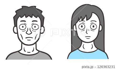 バセドウ病の症状が出ている男性と女性の顔 バセドウ病の症状が出ている男性と女性の顔 126363231