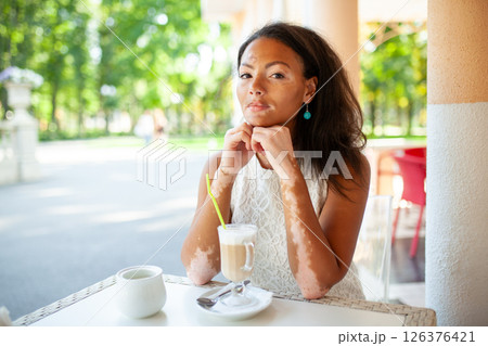 Young black woman with vitiligo sitting at Young black woman with vitiligo sitting at 126376421