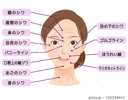 シワの種類　女性の顔　美容 126389441
