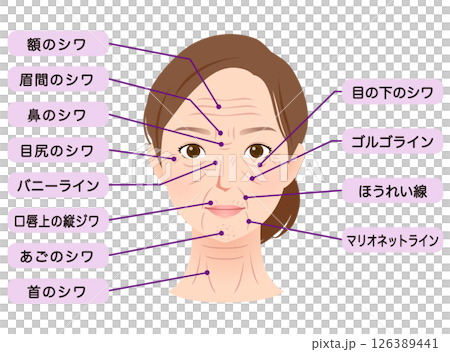 Types of wrinkles Women's face Beauty 126389441