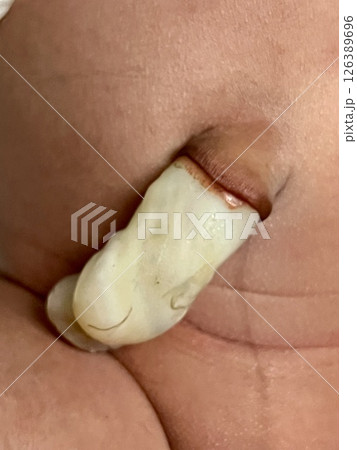 Close up of the fresh umbilical cord immediately after birth 126389696