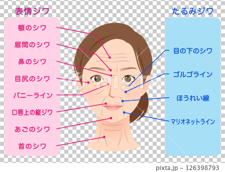 シワの種類　女性の顔　美容 126398793
