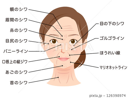 シワの種類　女性の顔　美容 126398974