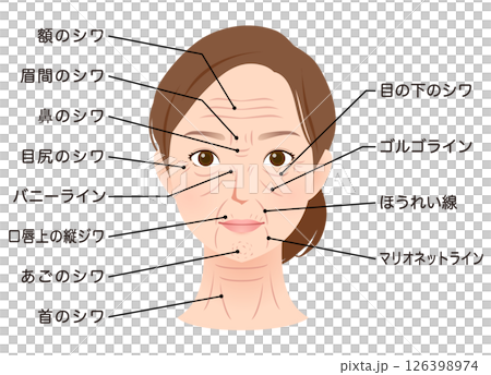 シワの種類　女性の顔　美容 126398974