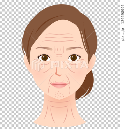 A woman's face with wrinkles, types of wrinkles, beauty A woman's face with wrinkles, types of wrinkles, beauty 126398993