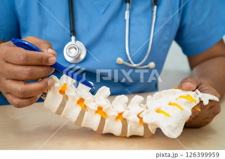Doctor with lumbar vertebra bone skeleton and nerve model for treatment in the orthopedic department. 126399959