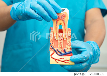 Asian dentist holding dental implant, artificial tooth roots into jaw, root canal of dental treatment, gum disease, teeth model for dentist. 126400395