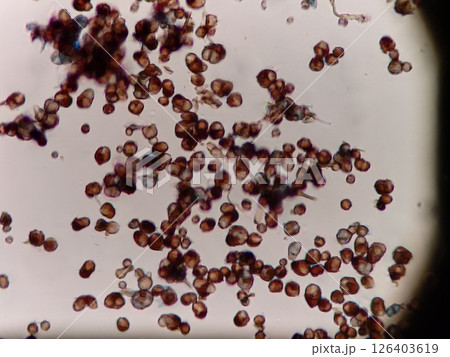 黒かびの胞子 126403619