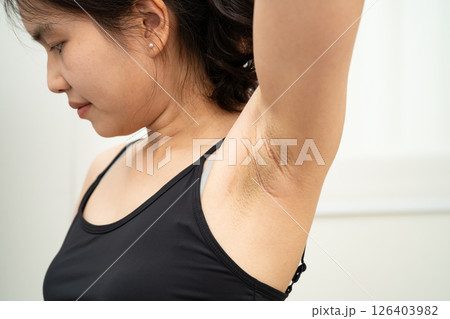 Asian woman have problem black armpit beauty skin care. 126403982