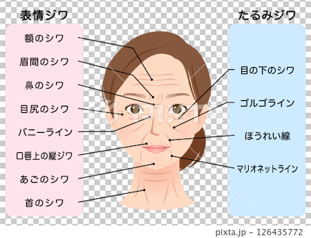 皺紋的類型 女性面部 美容 皺紋的類型 女性面部 美容 126435772