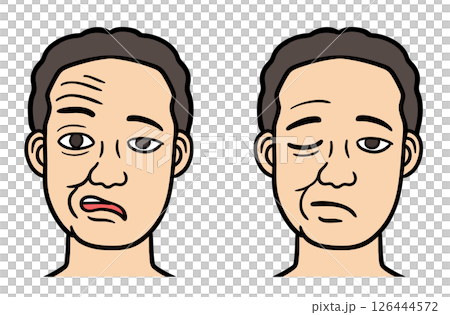 顔面神経麻痺の男性の顔 126444572