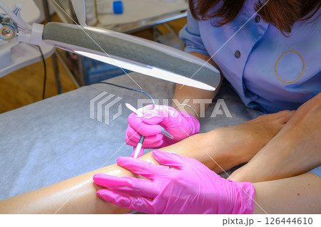 Young beautiful female dermatologist doing hair removal treatment on patient's legs with electrolysis. Epilation and beauty concept. High quality photo 126444610