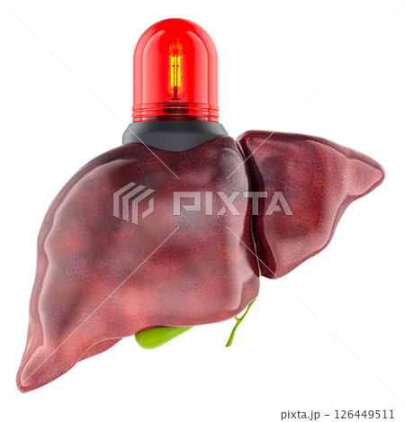 Liver with Emergency Warning Light. Medical urgency, liver disease, or a health warning. Liver failure, hepatitis, cirrhosis, or critical organ alert concept. 3D Illustration 126449511