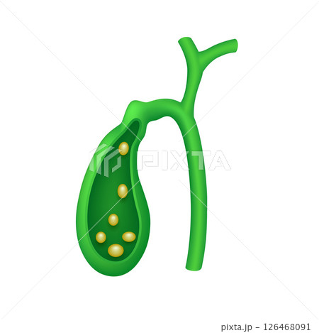 Cross section of human gallbladder internal organ anatomy model isolated on white background. Medicine and science concept. 3D icon vector illustration. For ads about health care. 126468091
