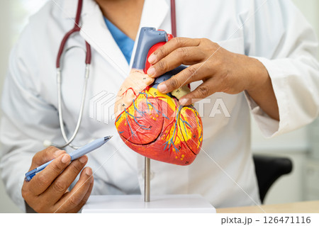 Cardiovascular disease CVD, Asian doctor holding human anatomy model for learn and treat heart disease. Cardiovascular disease CVD, Asian doctor holding human anatomy model for learn and treat heart disease. 126471116