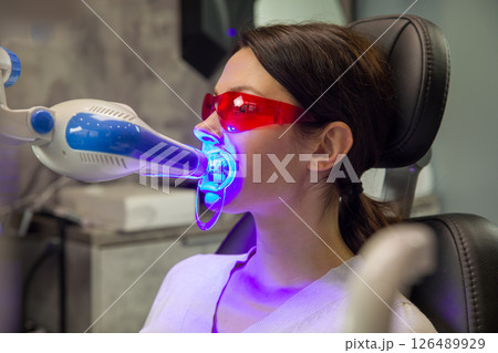 Dental procedure of laser teeth whitening, woman wearing red safety glasses and special mouthpiece. Dental procedure of laser teeth whitening, woman wearing red safety glasses and special mouthpiece. 126489929