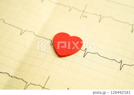 Electrocardiogram ECG, heart wave, heart attack, cardiogram report. Electrocardiogram ECG, heart wave, heart attack, cardiogram report. 126492581
